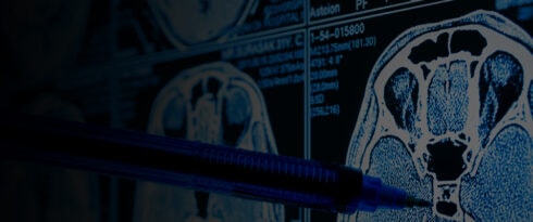 AI Healthcare