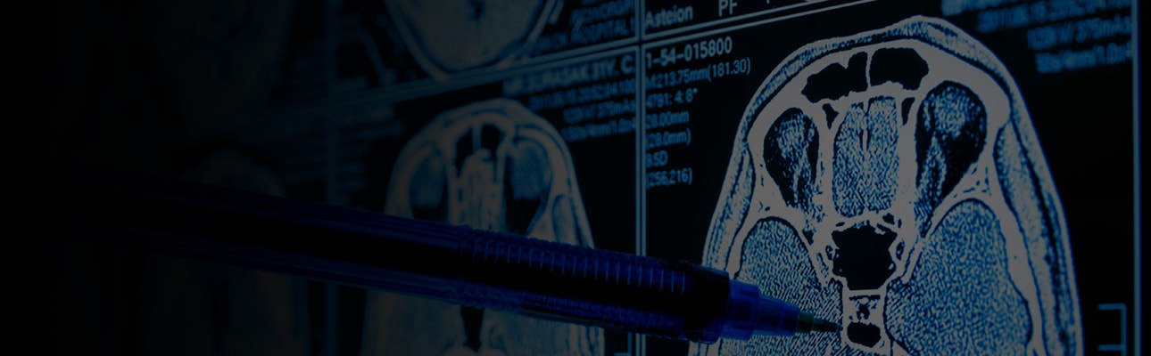 AI Healthcare